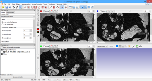 Importación de las
imágenes de resonancia magnética en el programa ScanIP.
