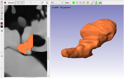 Construcción del
martillo en el programa ScanIP.