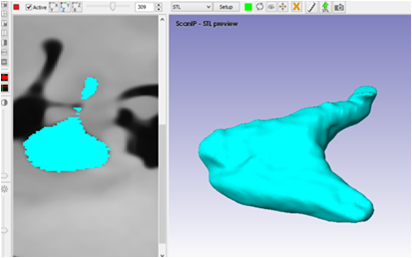 Construcción del
martillo en el programa ScanIP.
