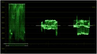 Se&ntilde;al de video con
luminancia saturada.