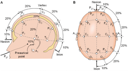 Sistema
Internacional 10-20 [8].