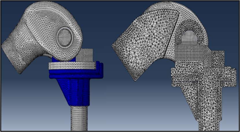 Malla del modelo de prtesis de rodilla con elementos hexadricos y tetradricos en funcin de la geometra de la pieza.