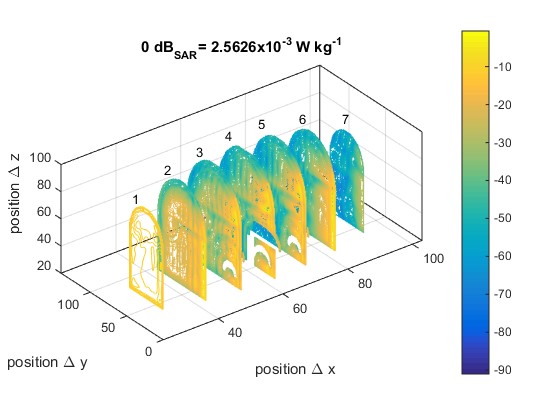 SAR distribution in the model of head used due to two sources of electromagnetic field. Values in dBSAR.