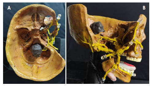 Prototipo del vil par craneal y su relación con la base del cráneo