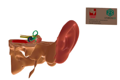 Modelo 3D digital del oído humano, creado por Nathalie Torres, 2021 (estudiante programa académico de Medicina y Cirugía- Universidad del Valle)