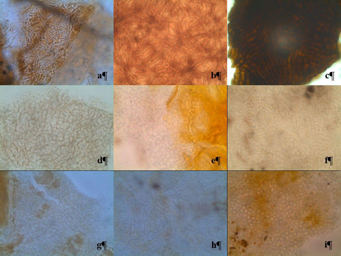Arreglo anatómico diferencial del manto externo de los morfotipos ectomicorrízicos mostrados en la figura 5 (a) M1 (plectenquimatoso tipo E), (b) M3 (pseudoparenquimatoso tipo K), (c) M4- Cenococcum geophilum (plectenquimatoso tipo G), (d) M10 (pseudoparenquimatoso tipo M), (e) M12 (plectenquimatoso tipo H), (f) M13 (plectenquimatoso tipo E), (g) M22 (pseudoparenquimatoso tipo P), (h) M23 (pseudoparenquimatoso tipo H) y (i) M27 (pseudorarenquimatoso (4) casi redondo).