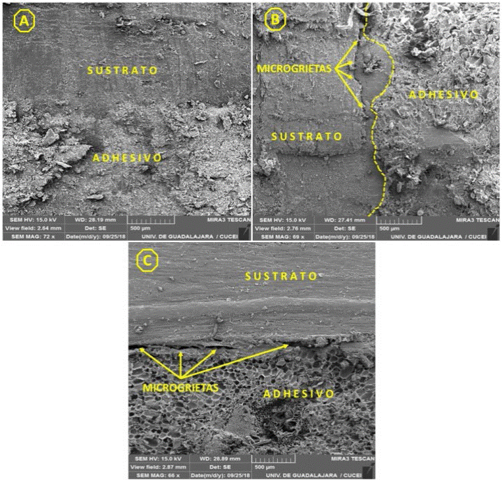 Localizaci&oacute;n de la interfase de los adhesivos. A) Adhesivo UF. B) Adhesivo SF. C) Adhesivo LC.