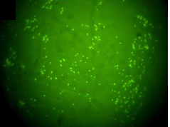 Direct fluorescence antibody test (DFAT) with polyclonal FITC conjugated anti-B. abortus serum. Spleen smear from sow infected with B. suis biovar 1 (100 inmersion oil).