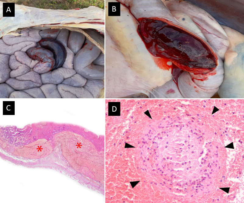Importar_Imgen5265c64616 Fig. 1. A. Hemorragia intestinal severa comprometiendo un segmento del yeyuno. B- Formacin de un extenso hematoma intra-mural que obstruye la luz intestinal. C- Micro-seccin transversal de la lesin intestinal donde se puede observar extensa hemorragia (asterisco) por debajo de la mucosa intestinal (H&E, 10X). D- Necrosis fibrinoide de la pared vascular (flechas) en la submucosa de la lesin (H&E, 40X). DISCUSIN Desde hace un par de dcadas una de las grandes problemticas de los rodeos lecheros a nivel nacional es la baja longevidad (2-3 lactancias/vaca) de los vientres como resultado de las altas tasas de mortalidad y descarte de vacas adultas registrados (Suarez et al., 2015). Ambas problemticas acortan la vida til de los vientres y comprometen el crecimiento a corto y mediano plazo de los rodeos (Rubio et al., 2016). Por este motivo, es fundamental conocer cules son las principales causas de muerte y descarte para tomar medidas de control adecuadas y as reducir estas tasas. Por lo antes dicho es indispensable avanzar en el diagnstico de las causas de muerte en vacas adultas en los rodeos lecheros. Segn informacin aportada por el programa CLAVES (2009), ms de un 60% de los diagnsticos de muerte en vacas lecheras permanecen indeterminados. Esta problemtica tambin es reconocida a nivel internacional y se debe a que existe poco hbito de hacer necropsia sistematizada en los establecimientos (Mc Connel et al., 2008). El “SHB” es una afeccin de creciente aparicin en E.E.U.U caracterizada por la presencia de una enteritis necro-hemorrgica segmental de curso agudo o sobreagudo generalmente mortal (Dennison et al., 2002; Peek et al., 2009; Adaska et al., 2014). Este trastorno normalmente ocurre durante los primeros 3 meses posparto (Berghaus et al., 2005). Es as, que se presume que el estrs fisiolgico asociado al pico de lactancia puede estar involucrado con la presentacin de este cuadro (Forsberg & Wang 2006). En este caso, la vaca afectada ya haba pasado el periodo de mayor riesgo y llevaba unos 5 meses en lactancia. Sin embargo, en un trabajo reciente De Jonge et al., (2023), mencionan la ocurrencia de casos de hasta 336 das posparto. En el SHB clsicamente se observa una hemorragia intestinal que suele afectar un segmento relativamente corto de intestino delgado capaz de generar fenmenos obstructivos (Dennison et al., 2002; Owaki et al., 2015). Dichas lesiones fueron identificadas en el caso aqu descripto y el diagnstico de la enfermedad se bas en estos hallazgos. Histolgicamente se evidenci una enteritis hemorrgica severa con vasculitis necrotizante y la formacin de hematomas submucosos en la pared intestinal tal como se describe en la bibliografa (Adaska et al., 2014; Owaki et al., 2015; De Jonge et al., 2023). Debido a la naturaleza de las lesiones antes descriptas, las vacas afectadas por “SHB” se debilitan rpidamente debido a hemorragia masiva y la obstruccin intestinal (Peek et al., 2009). Por este motivo, el cuadro suele ser agudo o sobreagudo y rara vez se identifican signos clnicos, eventualmente algn animal puede presentar un cuadro de clico y melena (Dennison et al., 2002). En el caso aqu presentado, el animal fue encontrado muerto sin evidencias de enfermedad previa. Si bien algunos autores sealan la posibilidad de Cl. perfringens tipo A intervenga en el desarrollo de la enfermedad, los estudios al respecto son contradictorios (Dennison et al., 2005; Forsberg & Wang, 2006; Peek et al, 2009; Adaska et al., 2014; De Jonge et al., 2023). Por lo pronto, correspondera ser cauteloso en atribuirle el origen de esta enfermedad a este agente. Debemos recordar, que Cl. perfringens tipo A es un germen ubicuo que se encuentra normalmente en el tracto digestivo de los rumiantes sin ocasionar problemas clnicos; es as que su sola presencia no puede ser considerada un hallazgo de relevancia diagnstica (Uzal 2016). Por este motivo, los estudios bacteriolgicos, no ofrecen mayores resultados al momento de efectuar el diagnstico de esta enfermedad. El SHB, ocurre comnmente como una enfermedad ocasional en rodeos lecheros intensivos, aunque algunas veces pueden verse afectadas varias vacas en un perodo de tiempo relativamente corto (Peek et al., 2009). En este establecimiento no existan antecedentes de la enfermedad y luego de la muerte del animal bajo estudio no ocurrieron nuevos casos. Algunos trabajos sealan que un factor comn en este sndrome es el consumo de dietas altas en energa y bajas en fibra (Berghaus et al., 2005). En el caso presentado en este trabajo, no es posible vincular la alimentacin con la presencia de la enfermedad. Avanzar en el conocimiento de las afecciones que ocasionan muerte en vacas adultas es sumamente importante para poder establecer medidas correctivas que permitan bajar las tasas de mortalidad observadas en los rodeos lecheros, tal como lo menciona Mc Connel et al., ( 2008) en EEUU. Segn la bibliografa consultada, este registro de “SHB” es el primero caso descripto en nuestro pas. Es as que esta enfermedad deba ser tenida en cuenta por los veterinarios de campo en casos de muerte sbita en vacas adultas en sistemas intensivos o semi-intensivos de produccin de leche. BIBLIOGRAFA. Adaska JM, Aly SS, Moeller RB, Blanchard PC, Anderson M, Kinde H, Uzal F. 2014. Jejunal hematoma in cattle: a retrospective case analysis. J. Vet. Diag. Inv. 26: 96-103. Anderson BC. 1991. Point-source haemorrhages in cows. Vet. Rec. 128:619-620. Berghaus RD, McCluskey BJ, Callan RJ. 2005. Risk factors associated with hemorrhagic bowel syndrome in dairy cattle. J. Am. Vet. Med. Assoc. 226: 1700-1706. CLAVES (Programa). 2009. Programa de asociacin tcnica AACREA, Elanco e INTA. http://www.pmpllaserenisima.com.ar:8090/Images/comunicados/noticias/Reporte%20final%20Claves De Jonge B, Pardon B, Goossens E, Van Immerseel F, Vereecke N, Pas ML, Callens J, Caliskan N, Roels S, Chiers K. 2023. Hemorrhagic bowel syndrome in dairy cattle: Gross, histological, and microbiological characterization. Vet. Path. 60: 235-244. Dennison AC, Van Metre DC, Callan RJ, Dinsmore P, Mason GL, Ellis RP. 2002. Hemorrhagic bowel syndrome of adult dairy cattle: 22 cases (1997-2000). J. Am. Vet. Med. Assoc. 221:686-689. Dennison AC, Van Metre DC, Morley PS, Callan RJ, Plampin EC, Ellis RP. 2005. Comparison of the odds of isolation, genotypes, and in vivo production of major toxins by Clostridium perfringens obtained from the gastrointestinal tract of dairy cows with hemorrhagic bowel syndrome or left-displaced abomasum. J. Am. Vet. Med. Assoc. 227: 132-138. Forsberg NE, Wang Y. 2006. Nutrition and immunity in dairy cattle: implications to hemorrhagic bowel syndrome. In Proceedings Mid-South Ruminant Nutritional Conference (pp. 11-20). McConnel FB, Garry JE, Lombard JA, Kidd AE, Hill DH, Gould J. 2008. A necropsy-based descriptive study of dairy cow deaths on a Colorado dairy C. S. Dairy. Sci. 92:1954–1962. Owaki S, Kawabuchi S, Ikemitsu K, Shono H, Furuoka H. 2015. Pathological findings of hemorrhagic bowel syndrome (HBS) in six dairy cattle cases. J. Vet. Med. Sci.14: 879-881. Peek SF, Santschi EM, Livesey MA, Prichard MA, McGuirk SM, Brounts SH. 2009. Edwards RB. Surgical findings and outcome for dairy cattle with jejunal hemorrhage syndrome: 31 cases (2000–2007). J. Am. Vet. Med. Assoc. 234: 1308–1312. Rubio NE, Andere CI, Rodrguez EM, Maizon DO, Casanova DE. Factores que afectan la longevidad en bovinos lecheros Holando argentino. 39 Congreso Argentino de Produccin Animal, Tandil, Argentina. 2016; 6, 36: 148. Suarez VH, Martnez GM. 2015. Caractersticas y Problemticas Productivas – Sanitarias de la Lechera del Valle de Lerma (Salta). INTA Ediciones, Col. Investigacin, desarrollo e innovacin. 66 p. ISBN 978-987-521-670-9. Uzal F. Diseases produced by Clostridium perfringens type A in mammalian species Cap. 8. In: Clostridial Diseases of Animals, First Edition. Francisco A. Uzal, J. Glenn Songer, John F. Prescott and Michel R. Popoff.  2016 John Wiley & Sons, Inc. Publicado 2016 por John Wiley & Sons, Inc Guardar   Inferencia de citas  Inferencia de contenido  Post-inferencia de referencias          Por favor, espere un momento...   Respaldos  Finalizar         Existen incongruencias en la captura Desea generar el archivo XML a pesar de ello?   Uno o ms errores encontrados en la captura de la informacin Favor de verificar lista de errores   El click derecho y el comando "ctrl + c" est deshabilitado por motivos de seguridad   Desea cerrar esta ventana? Si se cierra sus cambios en la marcacin de la ecuacin no sern guardados                                 Seleccione el estilo que desea para generar el PDF de su artculo Si necesita ver una vista previa del estilo, haga clic en su imagen correspondiente Para salir de la vista previa haga clic en cualquier parte                 Riga   Upsala   Malmo   Liminar               Si se requieren realizar modificaciones en un futuro, se le sugiere que conserve el mismo estilo de PDF elegido la primera vez que se gener el artculo
