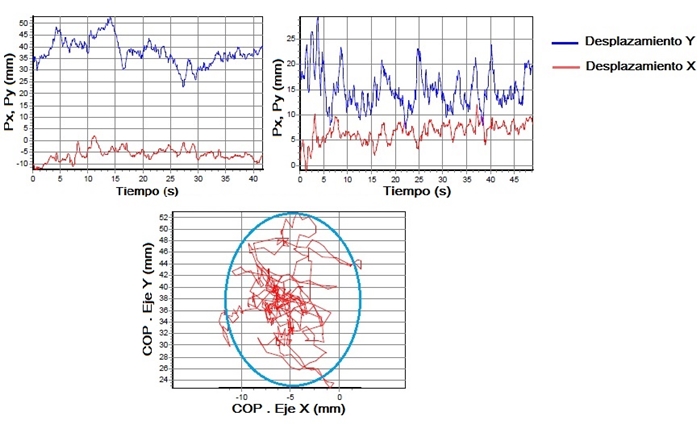 [Superior] Diagrama de los desplazamientos en el eje X y eje Y obtenidos del estudio. [Inferior] Diagrama de dispersi&oacute;n obtenido y patr&oacute;n generado.