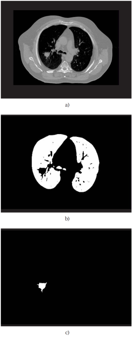 Resultados de la segmentaci&oacute;n de las estructuras de inter&eacute;s, (a) Imagen de TAC de pulm&oacute;n y tumor (fase de referencia); (b) Contorno de los pulmones obtenido por el m&eacute;todo propuesto; (c) Contorno de tumor pulmonar obtenido por el m&eacute;todo propuesto.