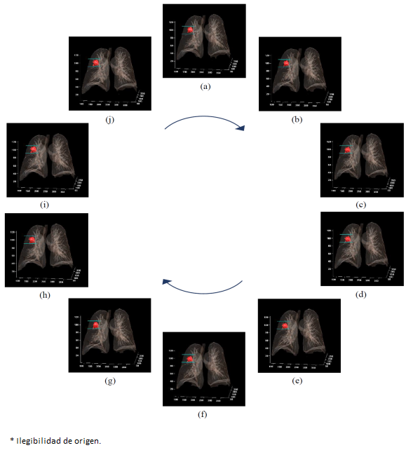 Reconstrucci&oacute;n tridimensional de las estructuras de los pulmones y tumor pulmonar en las fases del ciclo respiratorio, (a-e) Fase inspiratoria; (f-j) Fase espiratoria. Los ejes x, y son p&iacute;xeles y el eje z cortes transversales.