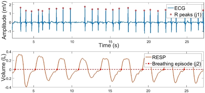 Original ECG and RESP signals after feature detection analysis. R peaks are shown in red diamonds above the ECG signal and breathing episodes are shown in red squares above the RESP signal.
