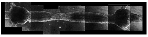 Lesión inducida en el SNC de H. officinalis, se muestra parte del nervio conectivo que une dos ganglios segmentales y el efecto de obturar las fibras nerviosas que conectan a los mismos debido a la lesión.