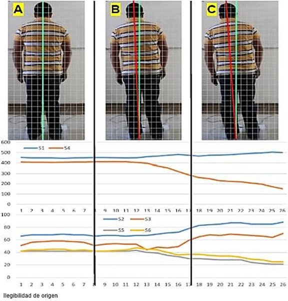 A) Postura estable, B) Movi&eacute;ndose, C) Inestable inclinado hacia la izquierda.
