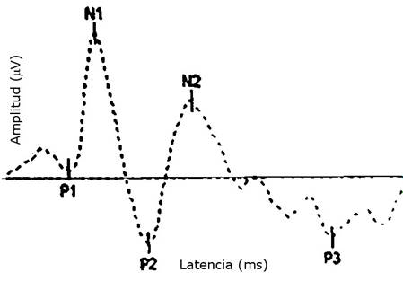 Representaci&oacute;n de un Potencial Evocado Visual experimental en rata. Software: Galileo NT.
