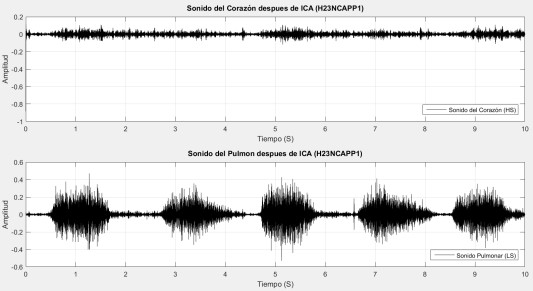 Se&ntilde;ales LS y HS despu&eacute;s de aplicar ICA.