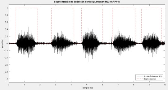 Se&ntilde;al LS en donde est&aacute; segmentada la actividad respiratoria.