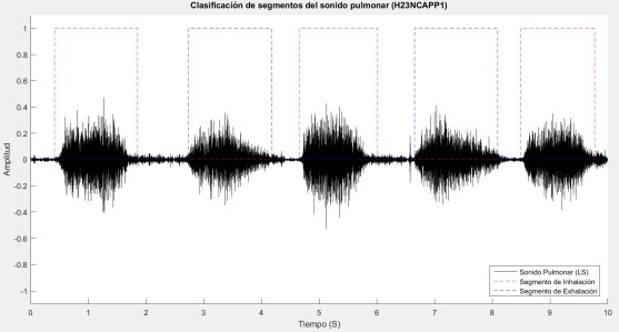 Segmentaci&oacute;n Autom&aacute;tica de la inspiraci&oacute;n y espiraci&oacute;n.