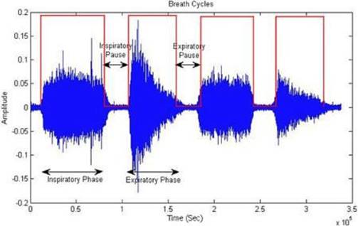 Segmentaci&oacute;n de la se&ntilde;al ac&uacute;stica de la respiraci&oacute;n usando VAD26.