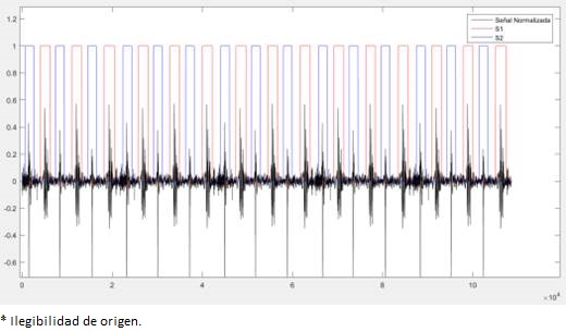 Identificaci&oacute;n de S1 y S2.
