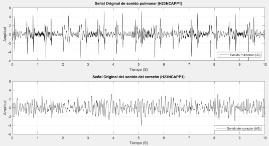 Se&ntilde;ales HS y LS centradas y blanqueadas.