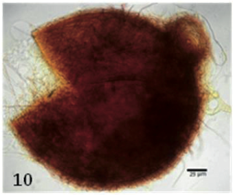 10. Diversispora globifera