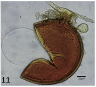 11. Glomus sp. aff. G. hyderabadensis