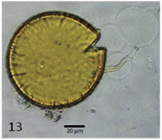 13. Glomus sp. aff. G. monosporum