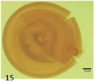 15. Glomus claroideum.