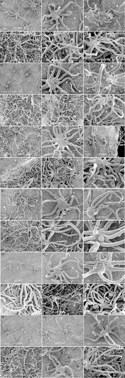 (1-36).Q. cordifolia: haz (1-3) y env&eacute;s (4-6). Q. deliquescens: haz (7-9) y env&eacute;s (10-12). Q. intricata: haz (13-15) y env&eacute;s (16-18). Q. microphylla: haz (19-21) y env&eacute;s (22-24). Q. mohriana: haz (25-27) y env&eacute;s (28-30). Q. striatula haz (31-33) y env&eacute;s (34-36). Superficie dorsal (A) y superficie ventral (B) de tricoma estrellado del haz de la l&aacute;mina. &Aacute;rea de uni&oacute;n del tricoma a la l&aacute;mina, descubierta al desprender el tricoma (C). Superficie dorsal (D) y superficie ventral (E) de tricoma estrellado del env&eacute;s de la l&aacute;mina. Tricoma glandular simple uniseriado (F). &Aacute;rea de uni&oacute;n de l&aacute;mina y tricoma, descubierta al desprender el tricoma (G). Tricoma estrellado con desarrollo radial a mayor &aacute;ngulo respecto a la superficie de la l&aacute;mina, con apariencia de tricoma fasciculado (H). Tricoma estrellado con radios adicionales a su desarrollo bidimensional radial, con apariencia de tricoma multirradiado (I). Tricomas glandulares capitados (J).
