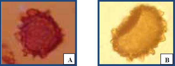 Esporas. A, espora peque&ntilde;a subesferoidal (40X). B, espora grande elipsoidal (40X).