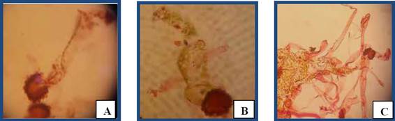 Germinaci&oacute;n. A, en musgo (40X). B, en maquique (40X). C, germinaci&oacute;n y filamentos en tierra de hoja (10X).