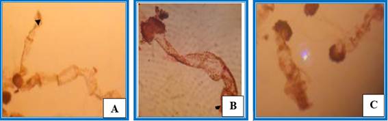 Fase filamentosa. A, en musgo (10X). B, en maquique (40X). C, en tierra de hoja (40X). Figs. 4A y 4B, la flecha se&ntilde;ala el tricoma terminal.
