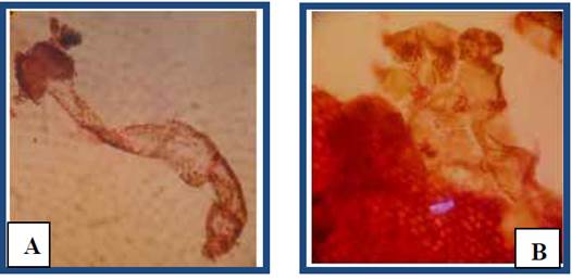 Desarrollo del pr&oacute;talo tipo Aspidium. A, tricoma inicial de un filamento (40X). B, pr&oacute;talo joven, mostrando dos tricomas en el gamet&oacute;fito (10X).