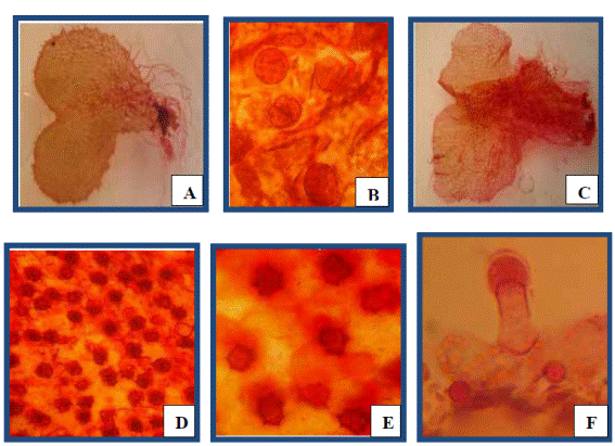 Gamet&oacute;fitos adultos en musgo. A, gamet&oacute;fito masculino (10X). B, anteridios (40X), C, gamet&oacute;fito femeninos (10X). D, vista de los arquegonios (40X), E, detalle de unos arquegonios inmaduros (100X). F, detalle de un tricoma de los pr&oacute;talos (40X).