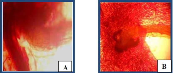 Formaci&oacute;n de yema apog&aacute;mica. A, en musgo (40X). B, en maquique (40X).