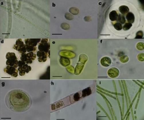 Clorofitas aisladas de biopelículas superficiales de la zona arqueológica de Malinalco. a: Geminella minor; b: Dicellula sp.; c: Gloeocystis vesiculosa d: Chlorokybus sp; e: Gongrosira pseudoprostrata; f: Chlorella vulgaris; g: Graesiella emersonii; h: Zygnema sp.; i: Klebsormidium flaccidum. Barra = 10 µm.