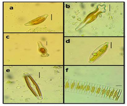 a. Cymbella affinis, b. Gomphonema acuminatum, c. Gomphonema truncatum, d. Navicula caroliniae, e. Craticula cuspidata, f. Fragilaria capucina. Escala: 10 &micro;m.