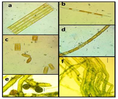 a, b. Ulnaria ulna; b, vista valvar. c. Diatoma vulgaris, d. Melosira varians, e, f. Vaucheria hamata; e, estructura reproductora. Escala: a, b, c, d, 10 &micro;m; f, 100 &micro;m