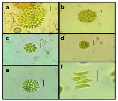 a. Pediastrum duplex, b. Pseudopediastrum boryanum var. longicorne, c, e. Stauridium tetras d. Golenkinia radiata, f. Acutodesmus acuminatus. Escala: 10 &micro;m.