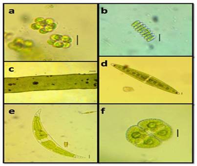 a. Coelastrum astroideum, b. Scenedesmus ellipticus, c. Ulva intestinalis, d. Closterium lanceolatum, e. Closterium moniliferum, f. Cosmarium botrytis. Escala: a, b, c, d, e, 10 &micro;m; f, 100 &micro;m. 