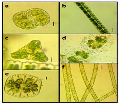 a. Cosmarium reniforme, b, c. Desmidium swartzii, d. Micrasterias americana, e. Micrasterias truncata, f. Spirogyra crassa. Escala: a, b, c, d, e, 10 &micro;m; f, 100 &micro;m. 