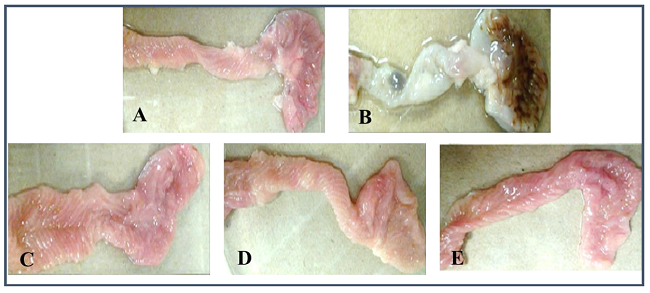 Fotograf&iacute;as de est&oacute;mago y duodeno de ratas tratadas con bicarbonato de sodio al 5% (A), indometacina (5 mg/kg de p.c.; B) y el extracto acuoso de G. seemannii (125, 250 y 500 mg/kg de p.c.; C, D y E, respectivamente).