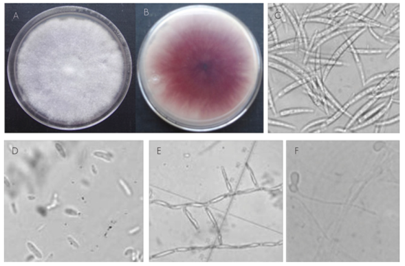 Morfolog&iacute;a de colonias y estructuras de reproducci&oacute;n asexual de Fusarium oxysporum Schltdl. obtenido de ra&iacute;ces de Pinus spp. con s&iacute;ntomas de pudrici&oacute;n de ra&iacute;z