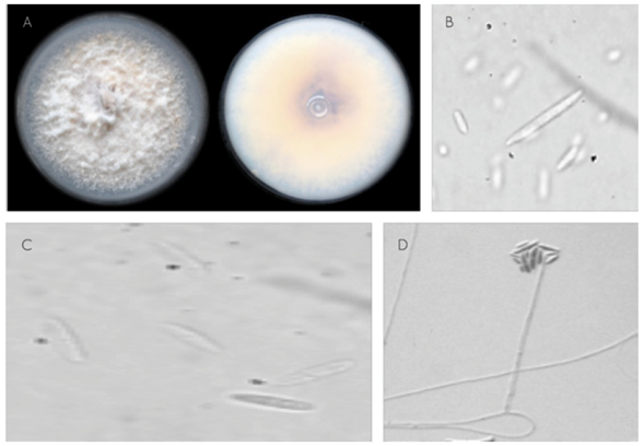 Morfolog&iacute;a de colonias y estructuras de reproducci&oacute;n asexual de Fusarium solani (Mart.) Sacc. obtenido de ra&iacute;ces de Pinus spp. con s&iacute;ntomas de pudrici&oacute;n de raz.
