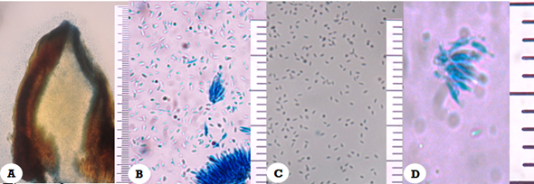Fotomicrografías de Chrysoporthe cubensis Brunes Gryzenhout & M. J. Wingf.