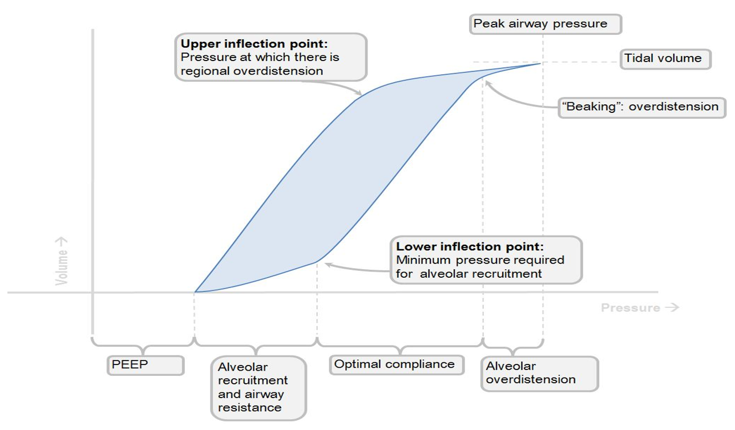 PressureVolume loop with lower inflection point