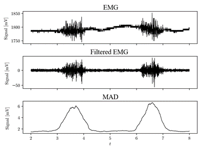 EMG: Raw Signal, filtered and its MAD