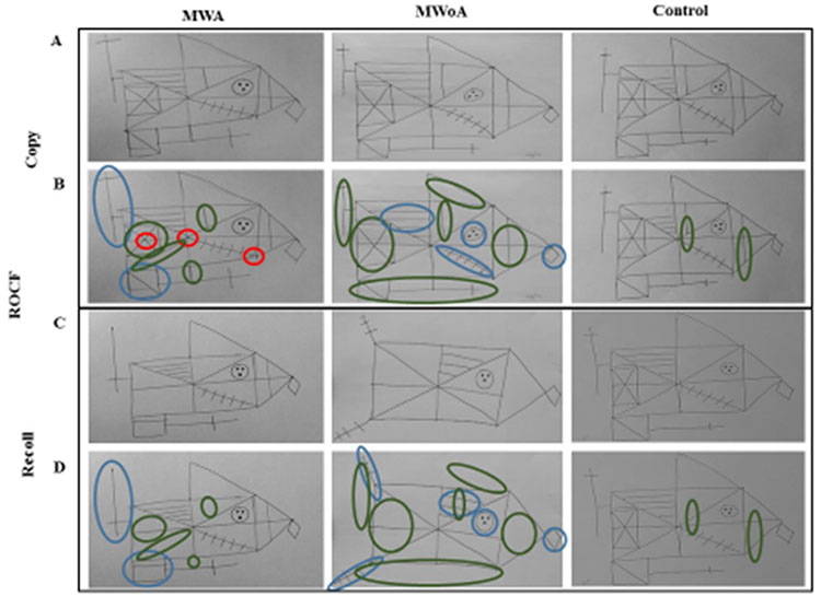 Significant sample execution ROCF
of each group